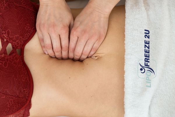 diastasis recti treatment Surrey