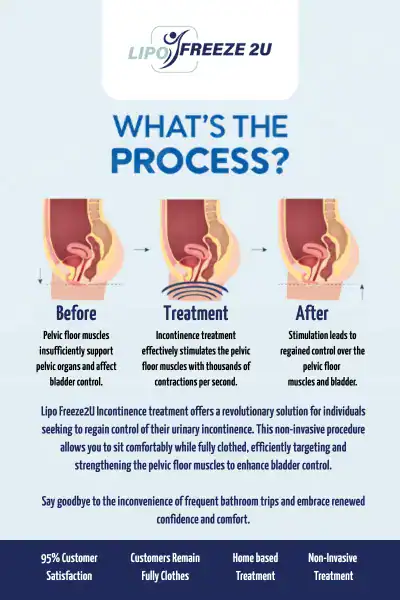 Diagram of how incontinence treatment Surrey works.