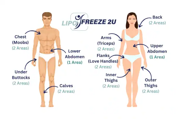 Areas you can have fat freezing treatment Surrey