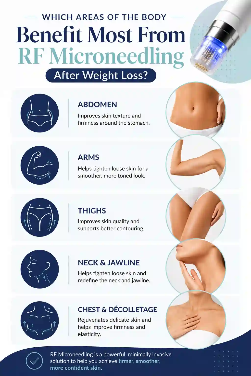 Which Areas of the Body Benefit Most From RF Microneedling After Weight Loss Surrey